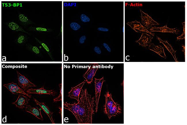 53BP1 Antibody in Immunocytochemistry (ICC/IF)