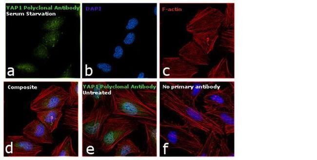 YAP1 Antibody in Immunocytochemistry (ICC/IF)