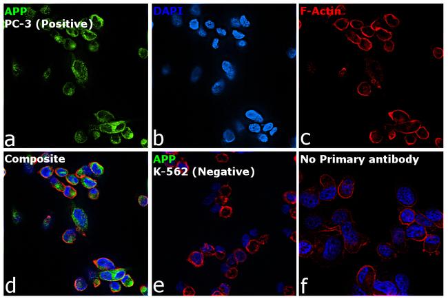 Amyloid Precursor Protein Antibody in Immunocytochemistry (ICC/IF)