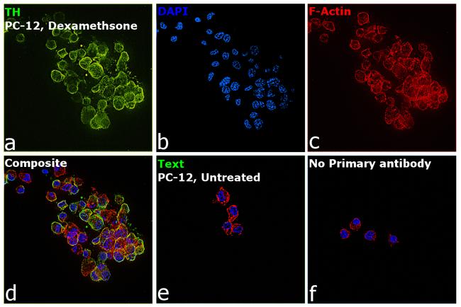 Tyrosine Hydroxylase Antibody in Immunocytochemistry (ICC/IF)