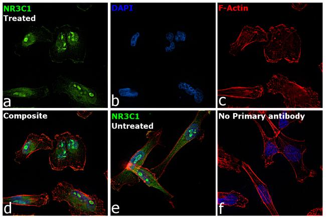 Glucocorticoid Receptor Antibody in Immunocytochemistry (ICC/IF)