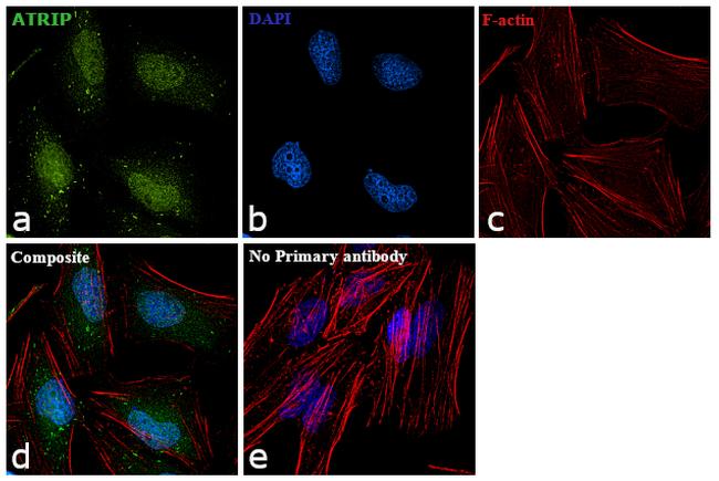 ATRIP Antibody in Immunocytochemistry (ICC/IF)