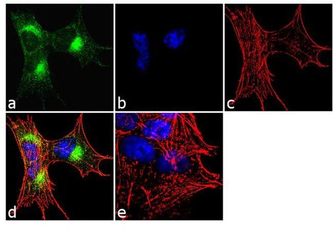 CaMKIV Antibody in Immunocytochemistry (ICC/IF)