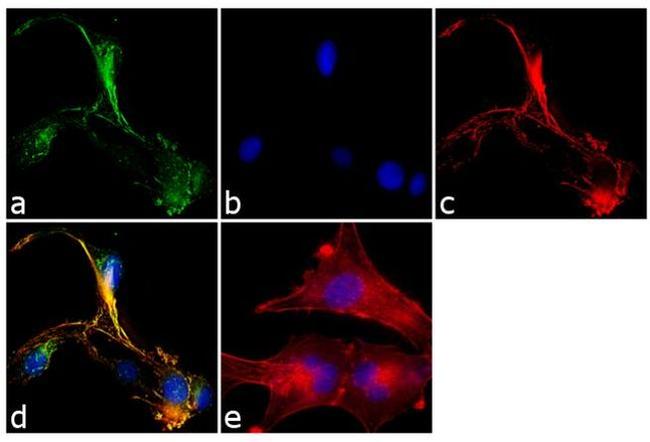 SNAP23 Antibody in Immunocytochemistry (ICC/IF)