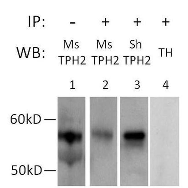 TPH2 Antibody in Immunoprecipitation (IP)