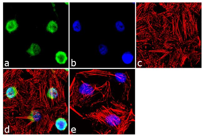 FOXL2 Antibody in Immunocytochemistry (ICC/IF)