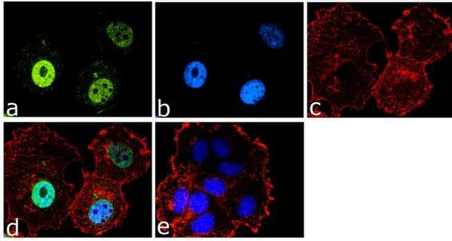 FOXO3A Antibody in Immunocytochemistry (ICC/IF)