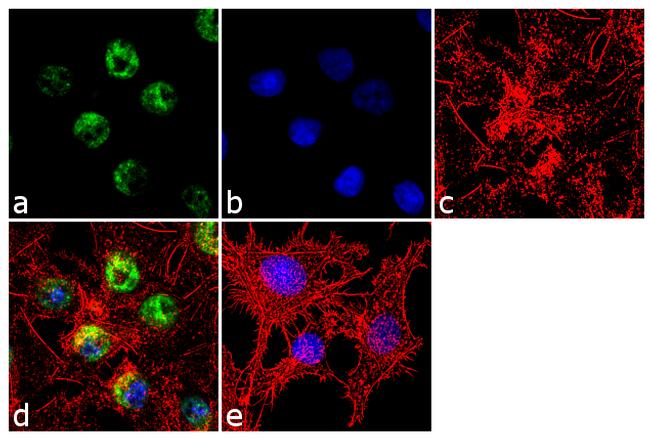 FOXC1 Antibody in Immunocytochemistry (ICC/IF)