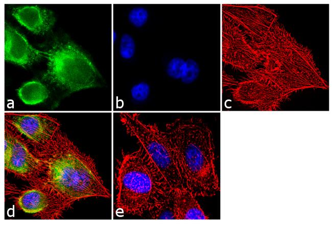 SRC2 Antibody in Immunocytochemistry (ICC/IF)