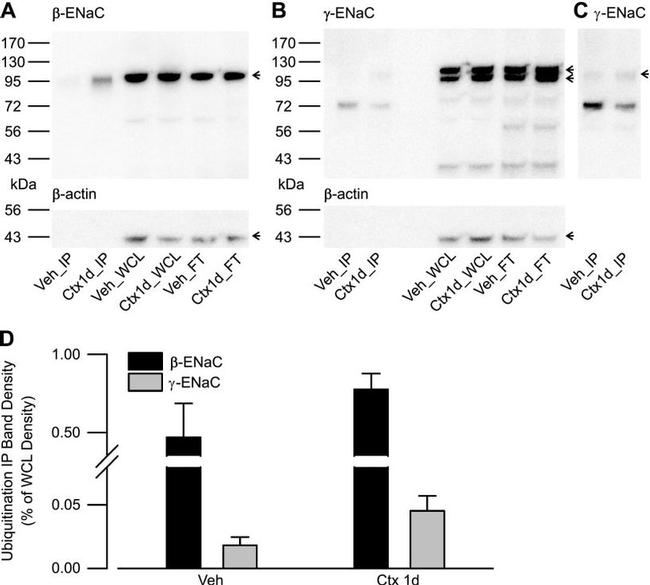 SCNN1G Antibody in Western Blot (WB)