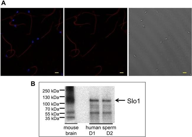 KCNMA1 Antibody in Immunocytochemistry (ICC/IF)