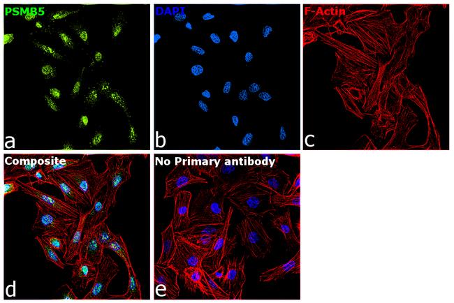 PSMB5 Antibody in Immunocytochemistry (ICC/IF)