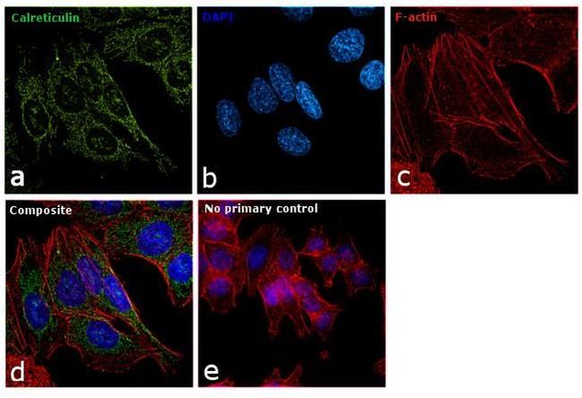 Calreticulin Antibody in Immunocytochemistry (ICC/IF)