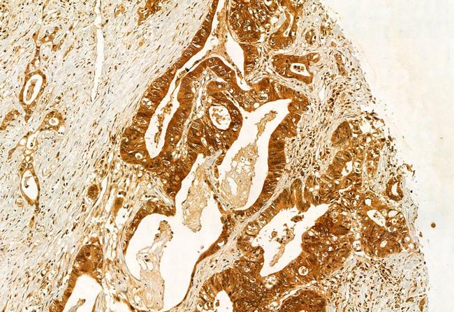 AdoHcyase 2 Antibody in Immunohistochemistry (Paraffin) (IHC (P))