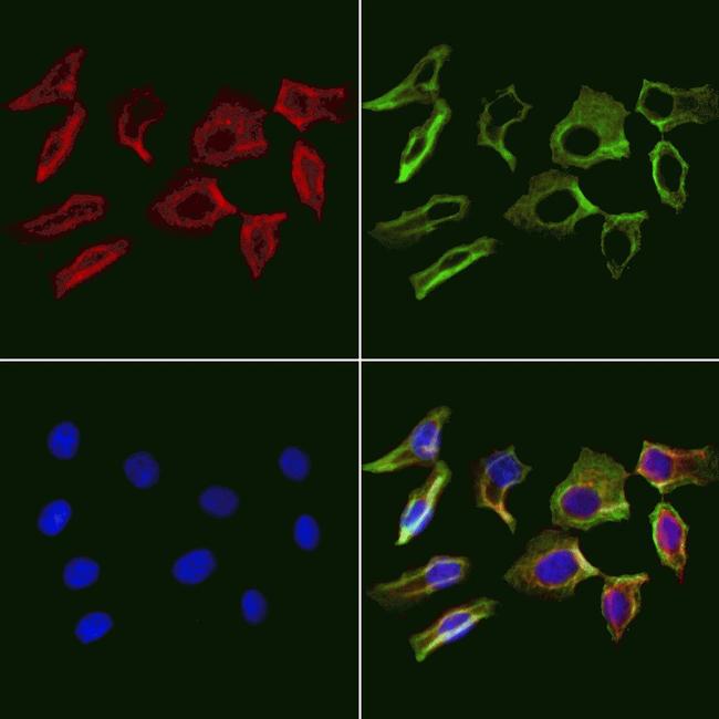 PDLIM7 Antibody in Immunocytochemistry (ICC/IF)