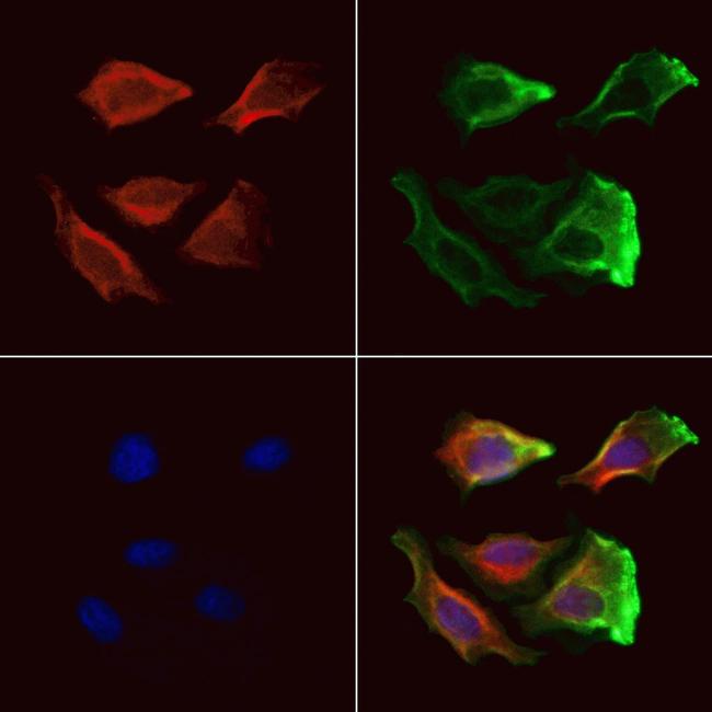 CAPZA1 Antibody in Immunocytochemistry (ICC/IF)