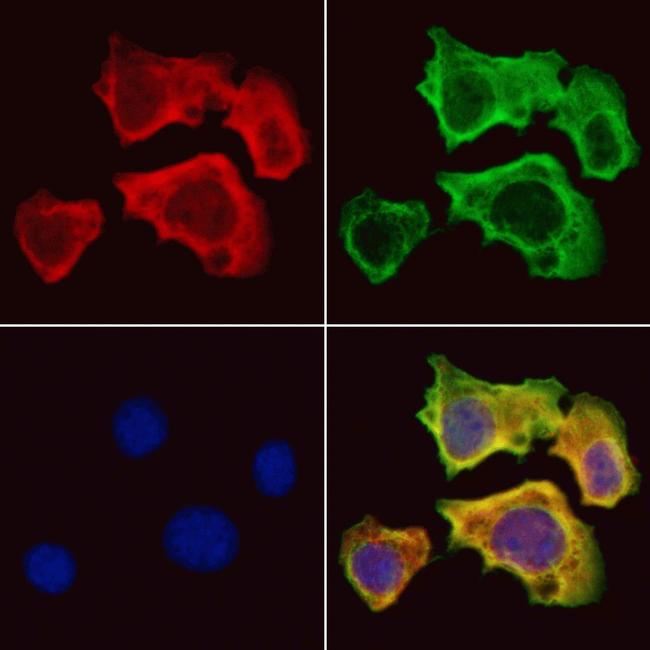 ISCU Antibody in Immunocytochemistry (ICC/IF)