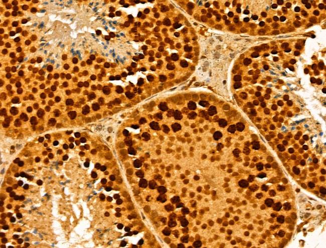 MCM10 Antibody in Immunohistochemistry (Paraffin) (IHC (P))