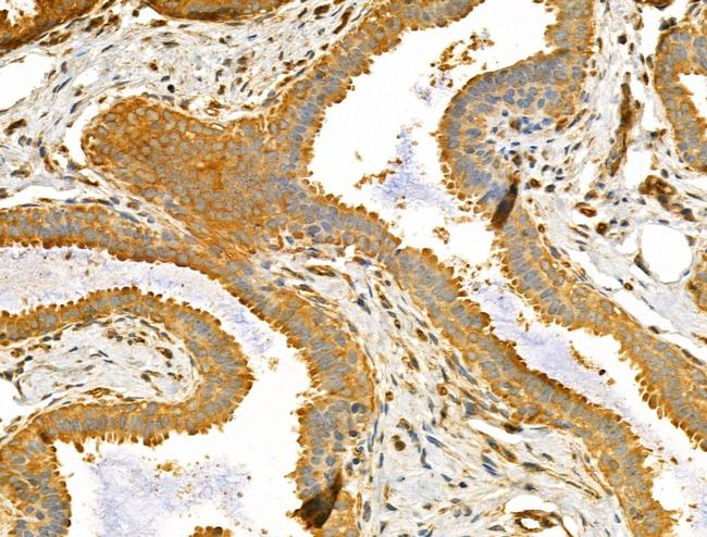 TTLL6 Antibody in Immunohistochemistry (Paraffin) (IHC (P))