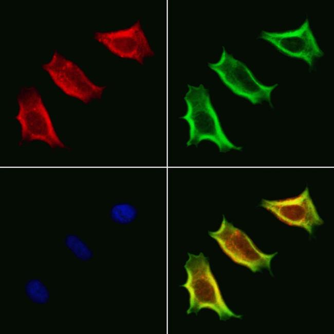 VPS33B Antibody in Immunocytochemistry (ICC/IF)