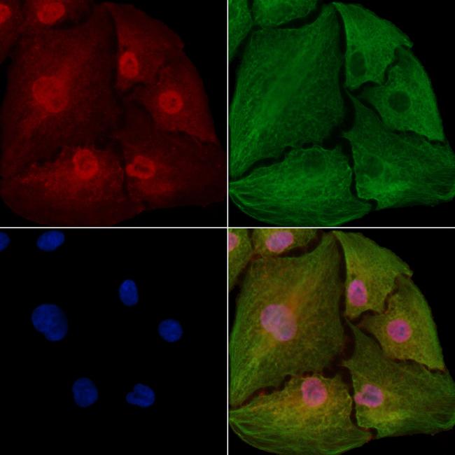 Annexin VII Antibody in Immunocytochemistry (ICC/IF)