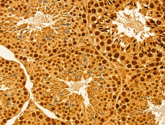 MMS19 Antibody in Immunohistochemistry (Paraffin) (IHC (P))