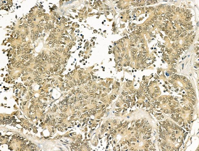 TLE3 Antibody in Immunohistochemistry (Paraffin) (IHC (P))