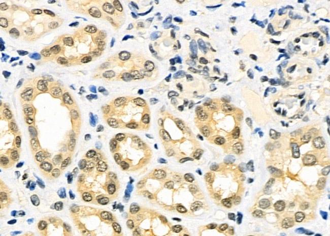 MEPCE Antibody in Immunohistochemistry (Paraffin) (IHC (P))