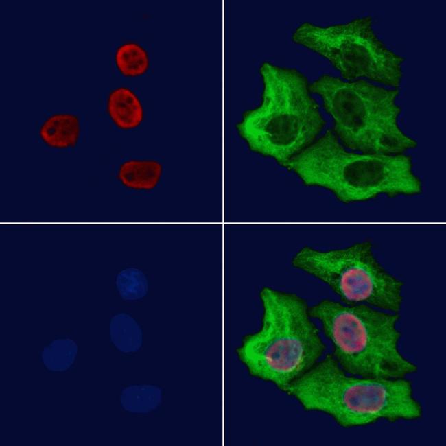 SFPQ Antibody in Immunocytochemistry (ICC/IF)