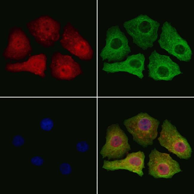 SMOX Antibody in Immunocytochemistry (ICC/IF)