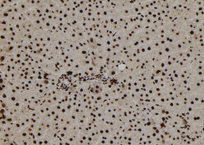 TNP1 Antibody in Immunohistochemistry (Paraffin) (IHC (P))