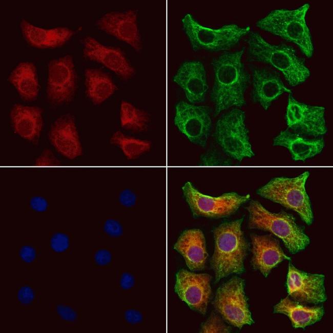 D4-GDI Antibody in Immunocytochemistry (ICC/IF)