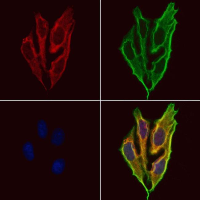 BAMBI Antibody in Immunocytochemistry (ICC/IF)