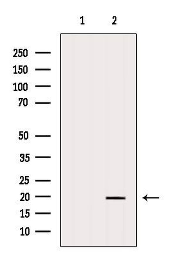 ARL6 Antibody in Western Blot (WB)