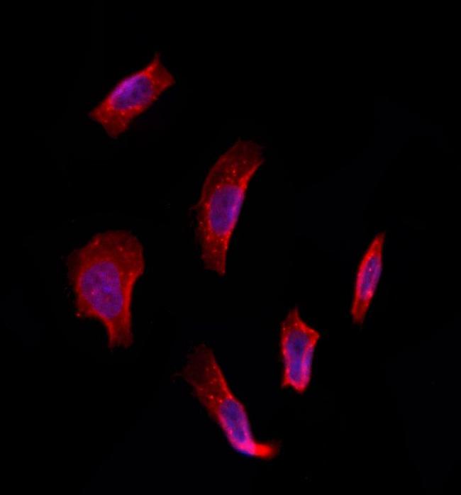 ETFDH Antibody in Immunocytochemistry (ICC/IF)