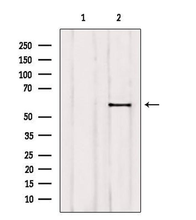 ETV5 Antibody in Western Blot (WB)