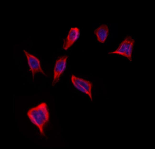 GMFG Antibody in Immunocytochemistry (ICC/IF)