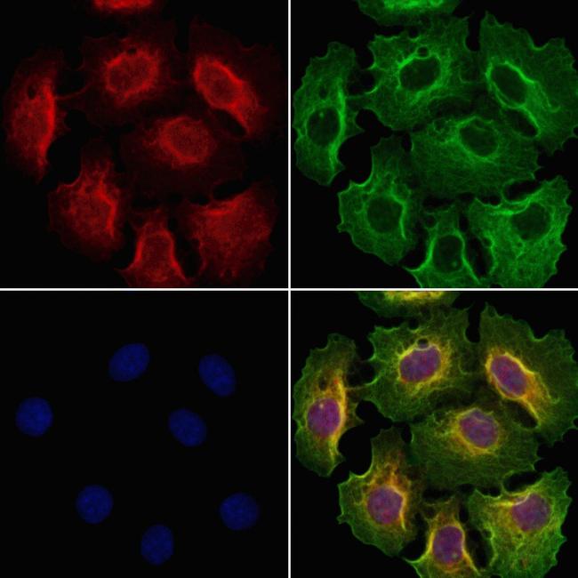 GSTM4 Antibody in Immunocytochemistry (ICC/IF)