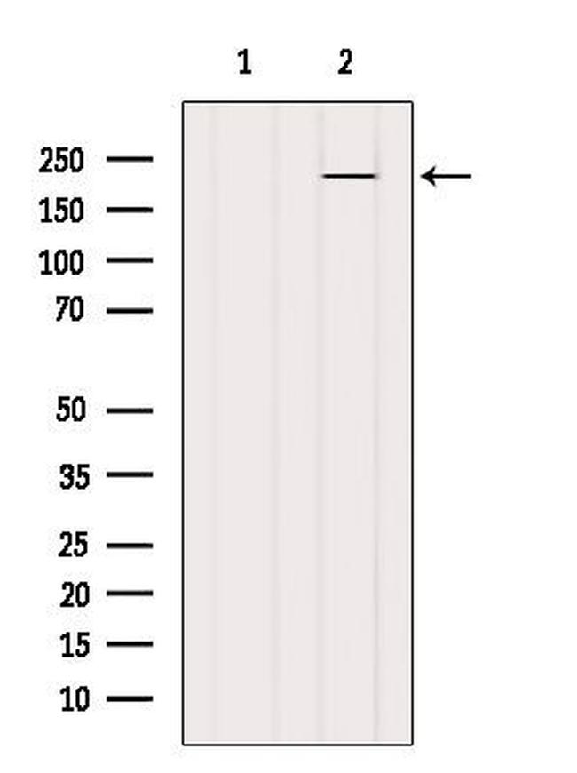 MYH6 Antibody in Western Blot (WB)