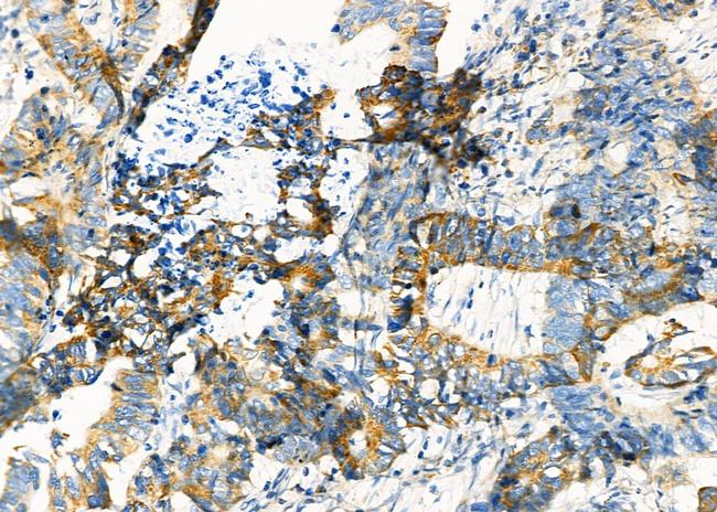 SHMT1 Antibody in Immunohistochemistry (Paraffin) (IHC (P))