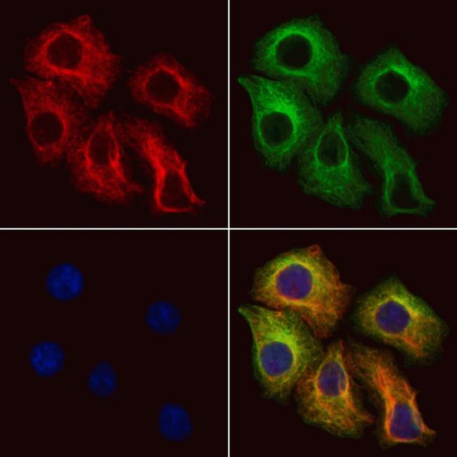 SLC25A46 Antibody in Immunocytochemistry (ICC/IF)