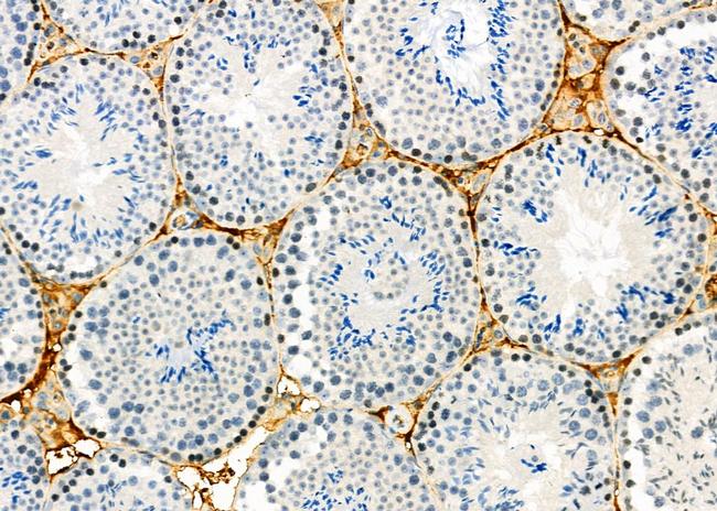 SPAG4L Antibody in Immunohistochemistry (Paraffin) (IHC (P))