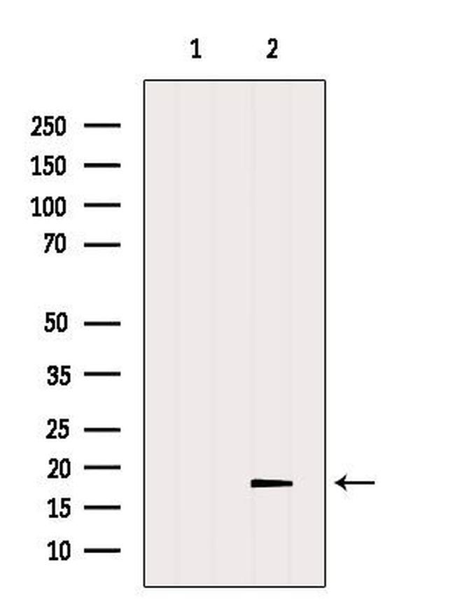 TMEM70 Antibody in Western Blot (WB)