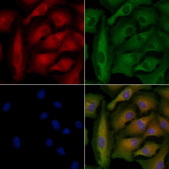 ABCB4 Antibody in Immunocytochemistry (ICC/IF)