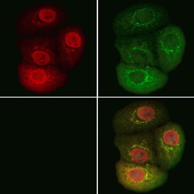 BCL9 Antibody in Immunocytochemistry (ICC/IF)