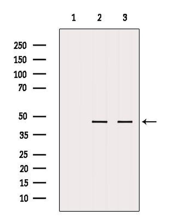 MTCH1 Antibody in Western Blot (WB)