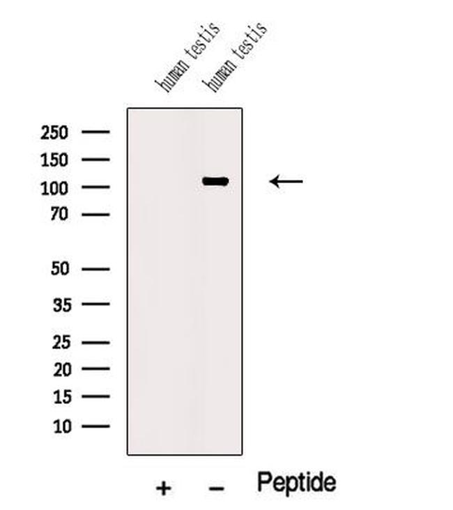 NUTM1 Antibody in Western Blot (WB)