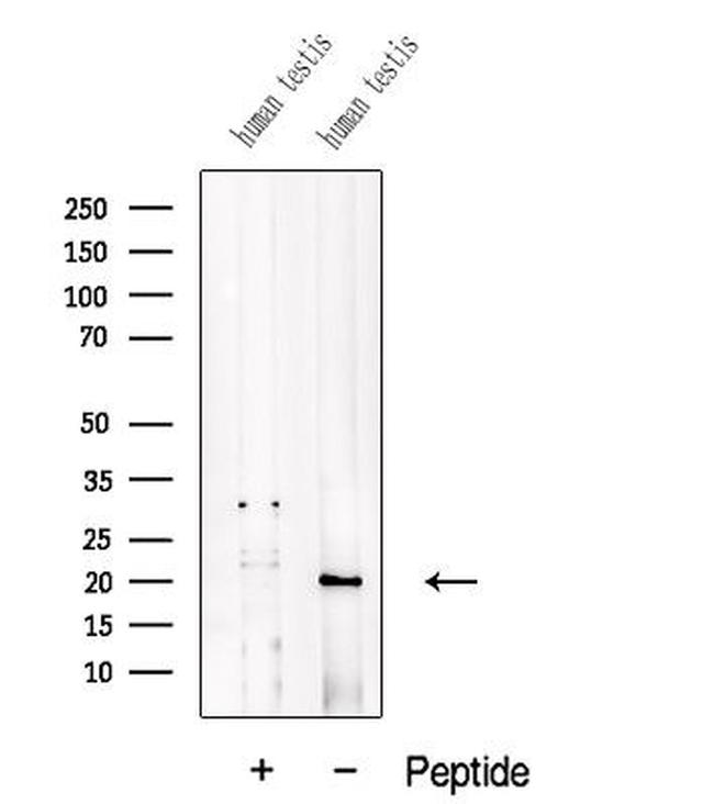 ADI1 Antibody in Western Blot (WB)