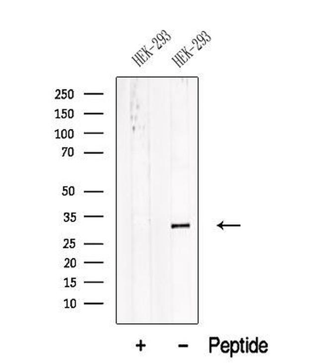 V-ATPase E1 Antibody in Western Blot (WB)