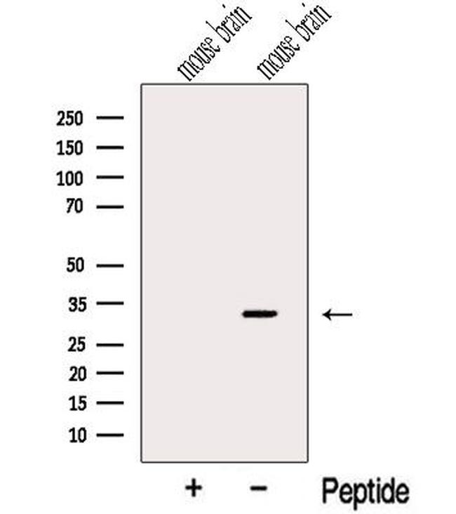 CHMP2B Antibody in Western Blot (WB)